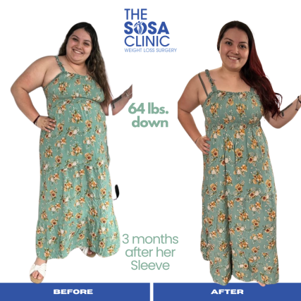 Bariatric Surgery Before and After Image TheSosaClinic.com Dr, Jorge Luis Sosa